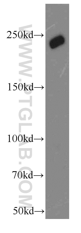 Western Blot (WB) analysis of K-562 cells using URB1-Specific Polyclonal antibody (20023-1-AP)