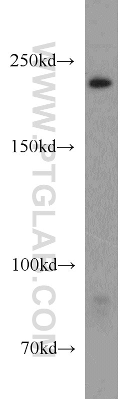 Western Blot (WB) analysis of K-562 cells using URB1-Specific Polyclonal antibody (20023-1-AP)