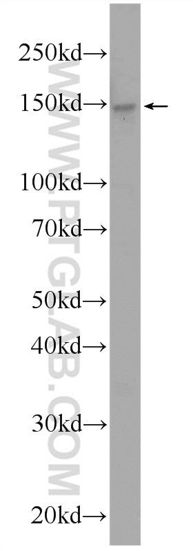 Western Blot (WB) analysis of HeLa cells using URB2 Polyclonal antibody (24881-1-AP)