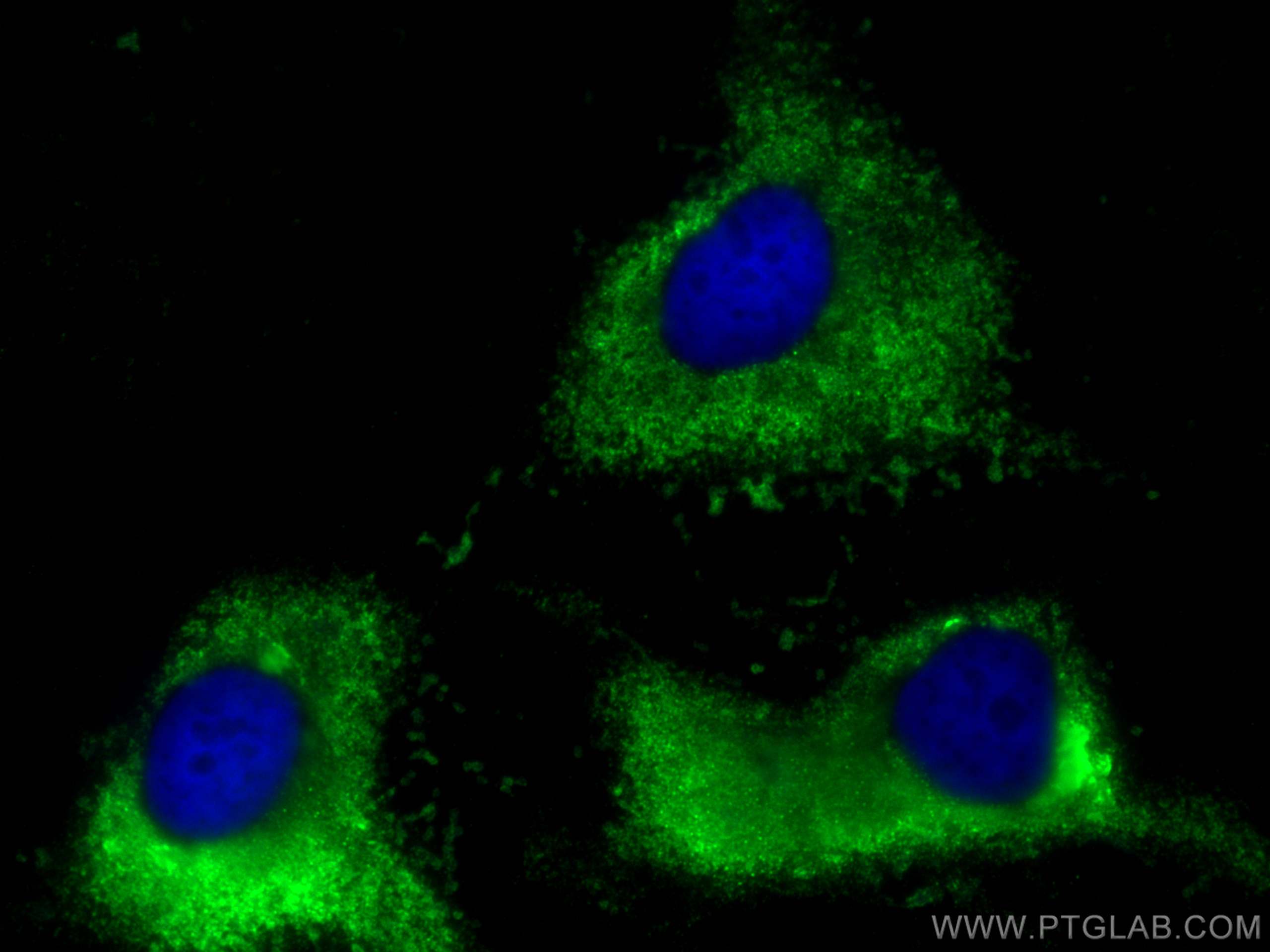 Immunofluorescence (IF) / fluorescent staining of HeLa cells using URG4 Polyclonal antibody (11998-1-AP)