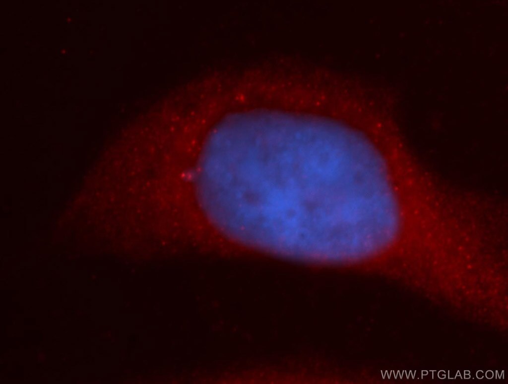 Immunofluorescence (IF) / fluorescent staining of HeLa cells using URG4 Polyclonal antibody (11998-1-AP)