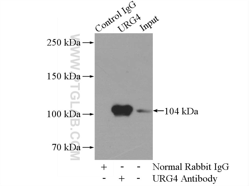 Immunoprecipitation (IP) experiment of HEK-293 cells using URG4 Polyclonal antibody (11998-1-AP)