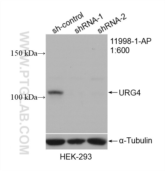 Western Blot (WB) analysis of HEK-293 cells using URG4 Polyclonal antibody (11998-1-AP)