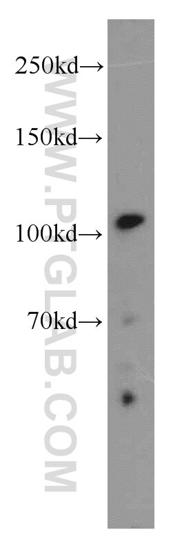 Western Blot (WB) analysis of HEK-293 cells using URG4 Polyclonal antibody (11998-1-AP)