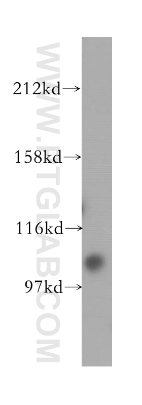 Western Blot (WB) analysis of HEK-293 cells using URG4 Polyclonal antibody (11998-1-AP)