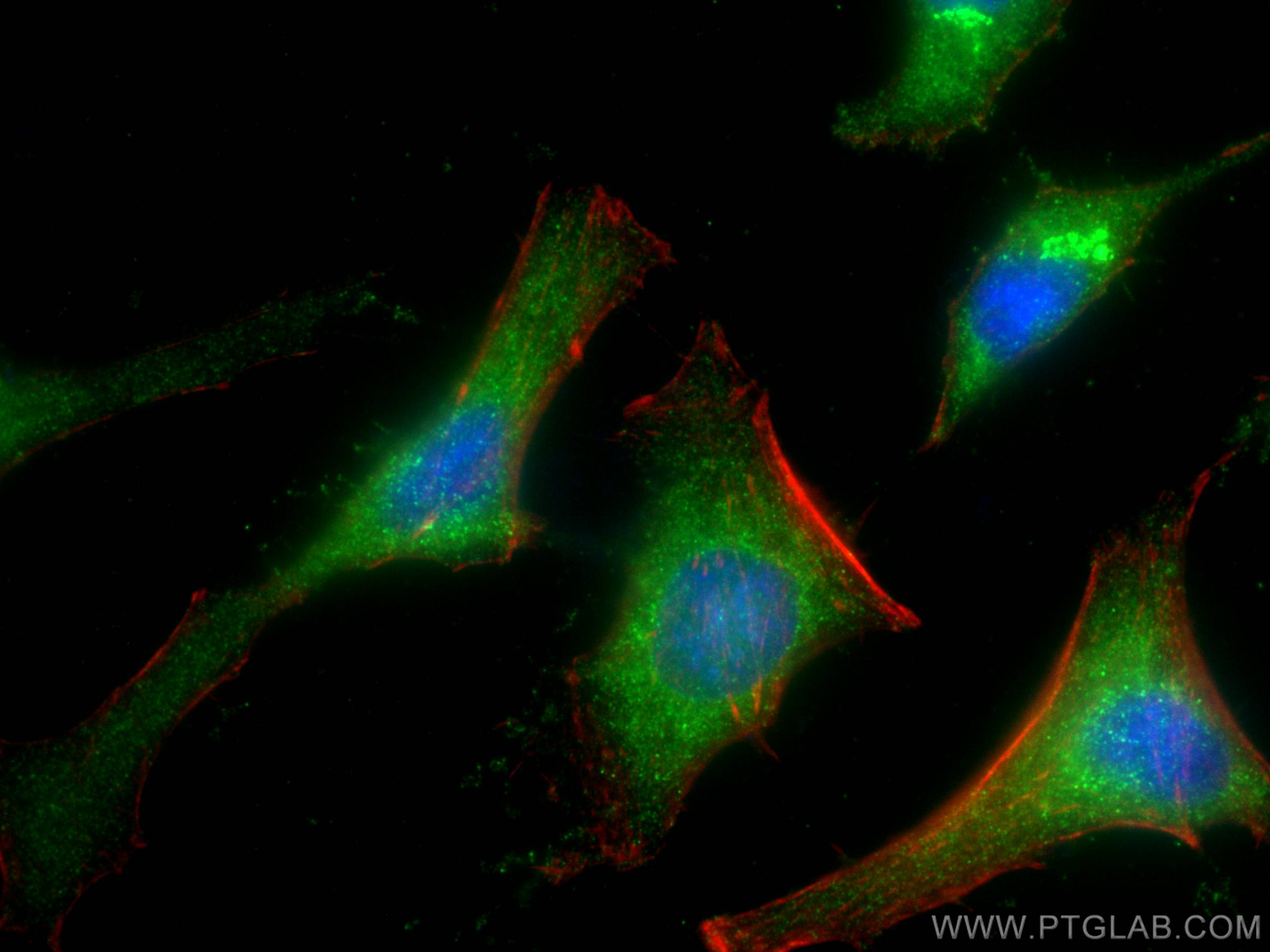 Immunofluorescence (IF) / fluorescent staining of HeLa cells using URG4 Monoclonal antibody (67144-1-Ig)
