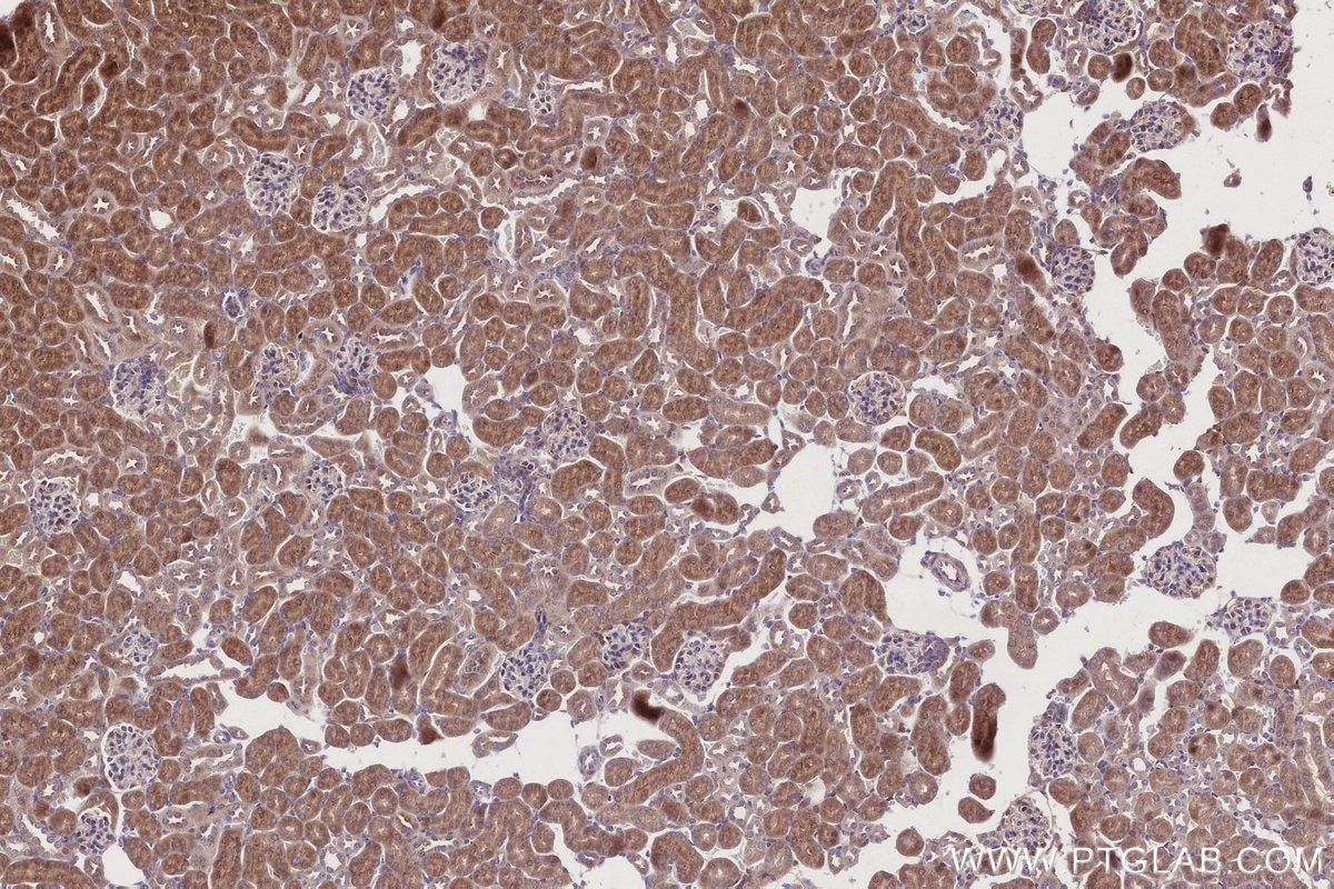 IHC staining of mouse kidney using 67144-1-Ig Immunohistochemistry (IHC) staining of mouse kidney tissue using URG4 Monoclonal antibody (67144-1-Ig)