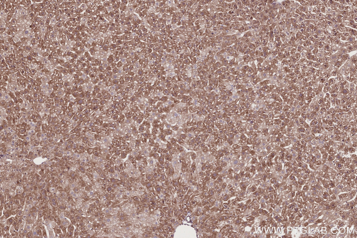 IHC staining of mouse liver using 67144-1-Ig Immunohistochemistry (IHC) staining of mouse liver tissue using URG4 Monoclonal antibody (67144-1-Ig)