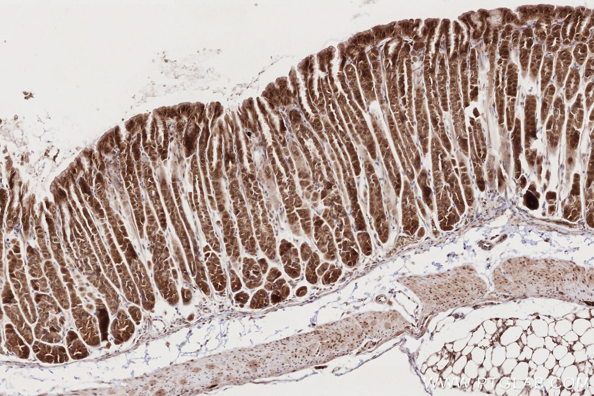 IHC staining of mouse stomach using 67144-1-Ig Immunohistochemistry (IHC) staining of mouse stomach tissue using URG4 Monoclonal antibody (67144-1-Ig)