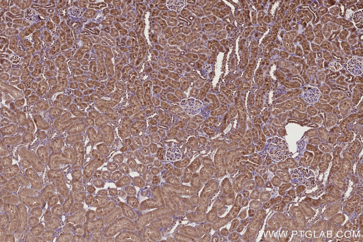 IHC staining of rat kidney using 67144-1-Ig Immunohistochemistry (IHC) staining of rat kidney tissue using URG4 Monoclonal antibody (67144-1-Ig)