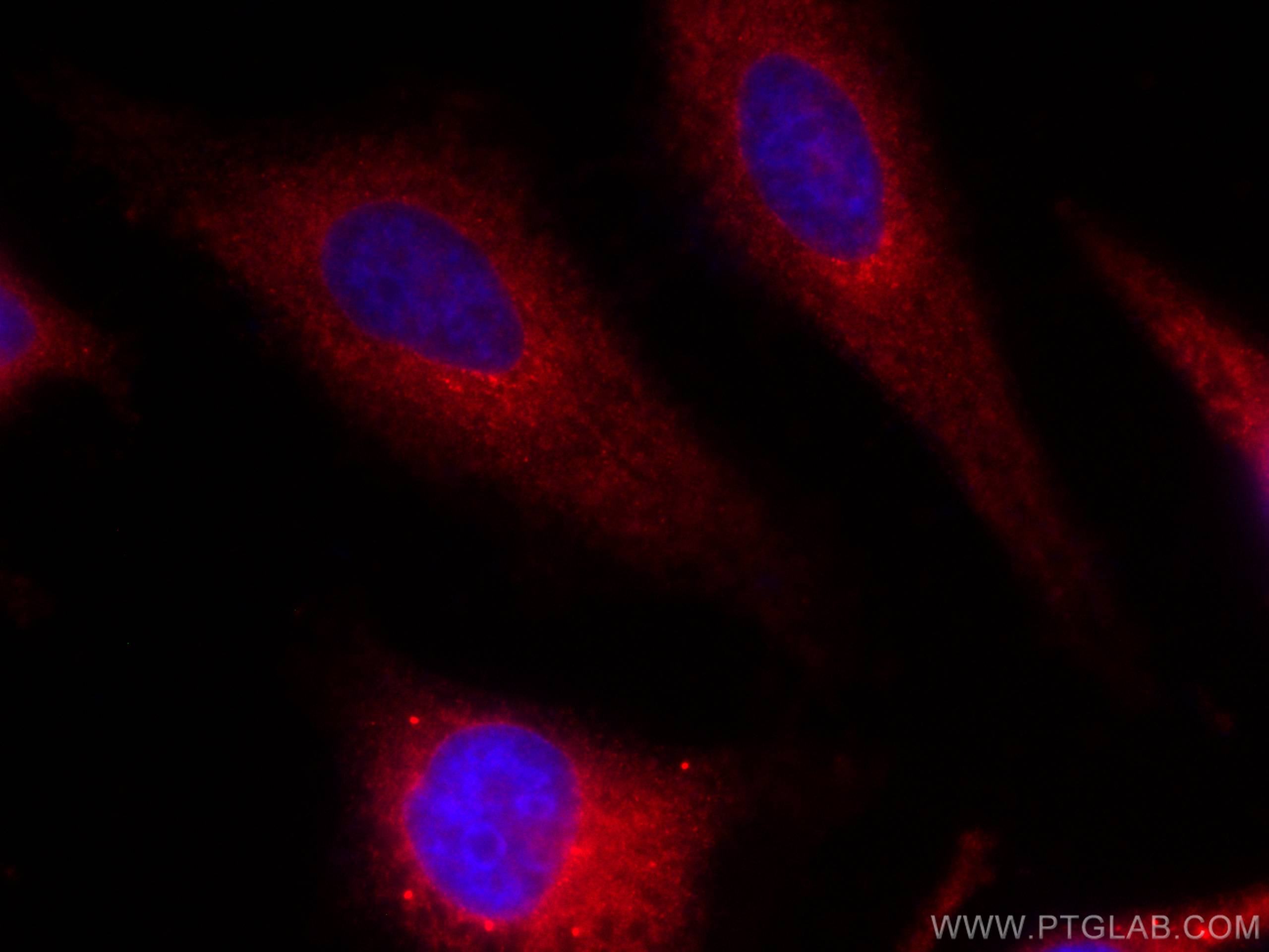 Immunofluorescence (IF) / fluorescent staining of HeLa cells using CoraLite®594-conjugated URG4 Monoclonal antibody (CL594-67144)