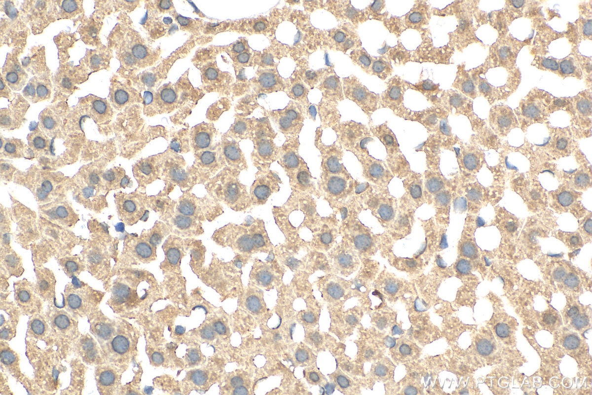 IHC staining of mouse liver using 15285-1-AP