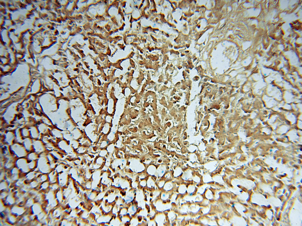 IHC staining of human liver using 15285-1-AP