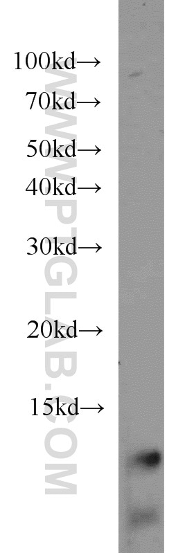 Western Blot (WB) analysis of A549 cells using URM1 Polyclonal antibody (15285-1-AP)