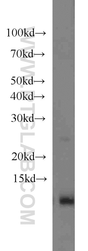 WB analysis of A549 using 15285-1-AP