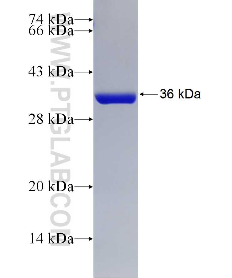 URM1 fusion protein Ag7448 SDS-PAGE