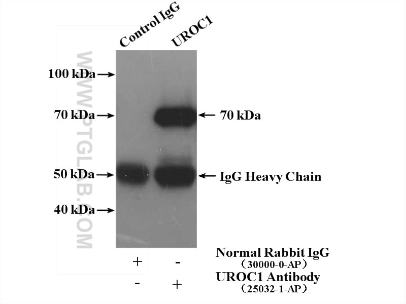 Immunoprecipitation (IP) experiment of mouse liver tissue using UROC1 Polyclonal antibody (25032-1-AP)