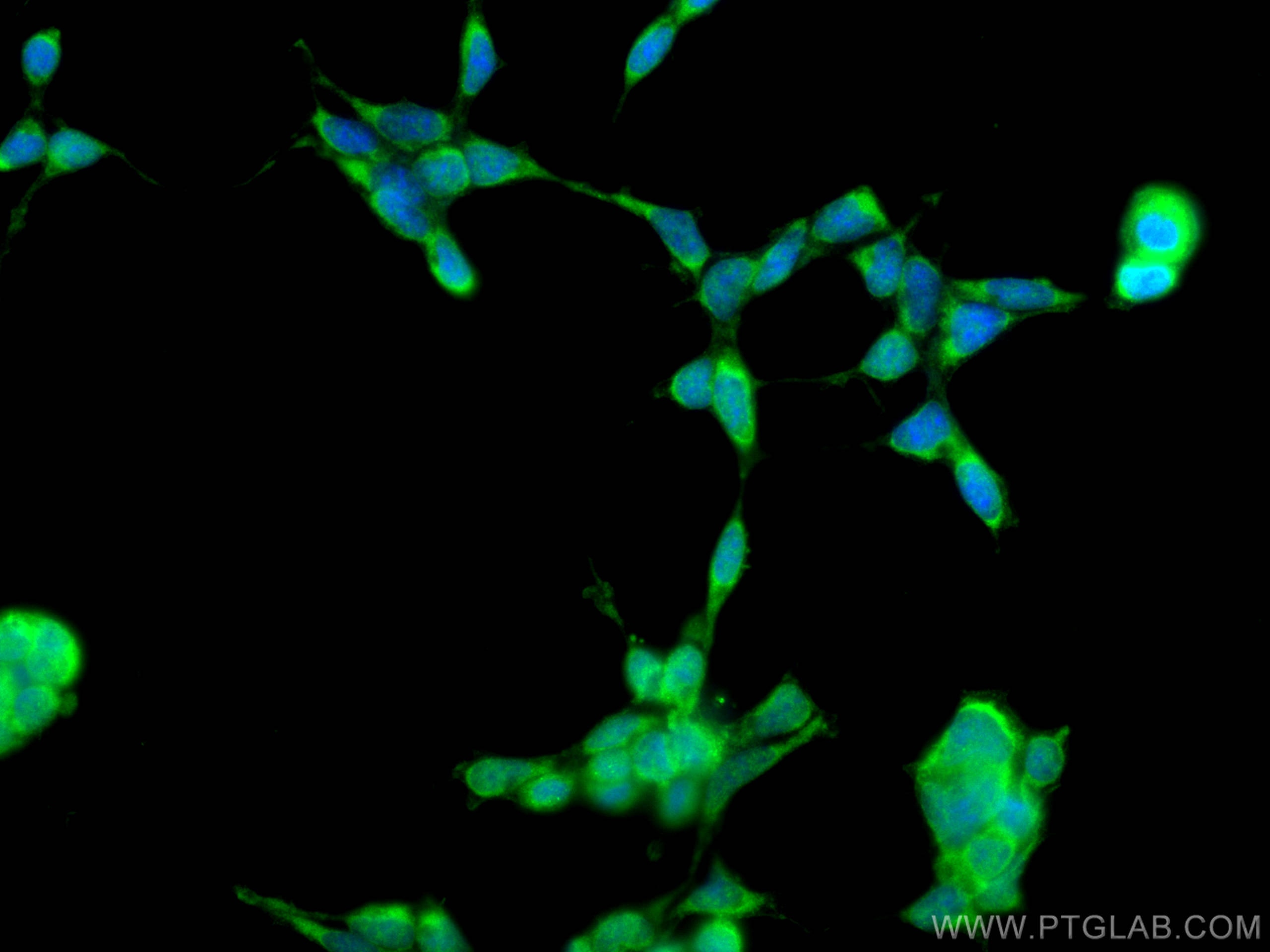 Immunofluorescence (IF) / fluorescent staining of HEK-293 cells using UROD Polyclonal antibody (15547-1-AP)