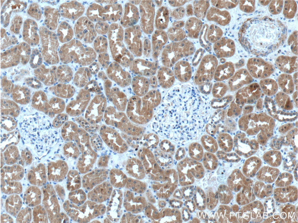 Immunohistochemistry (IHC) staining of human kidney tissue using UROD Polyclonal antibody (15547-1-AP)