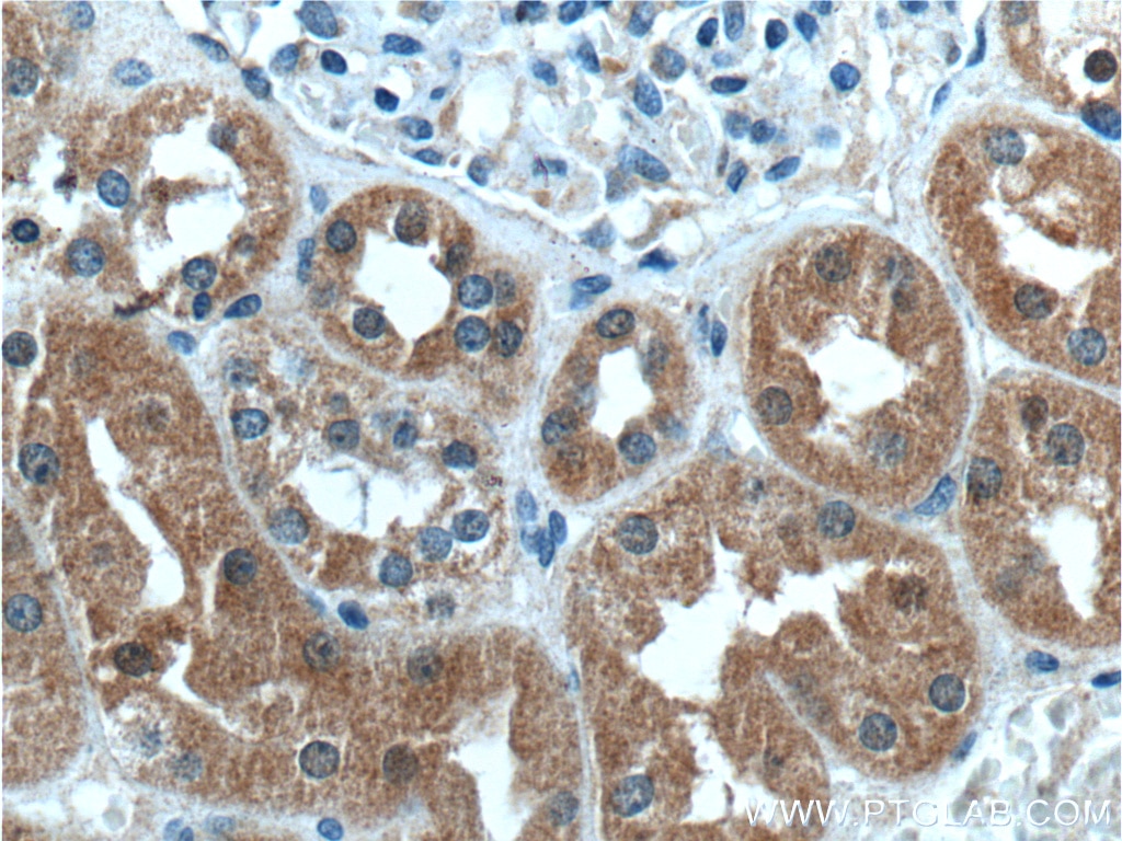 IHC staining of human kidney using 15547-1-AP