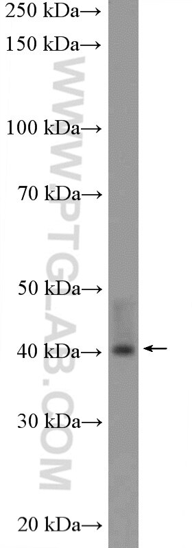 Western Blot (WB) analysis of rat kidney tissue using UROD Polyclonal antibody (15547-1-AP)