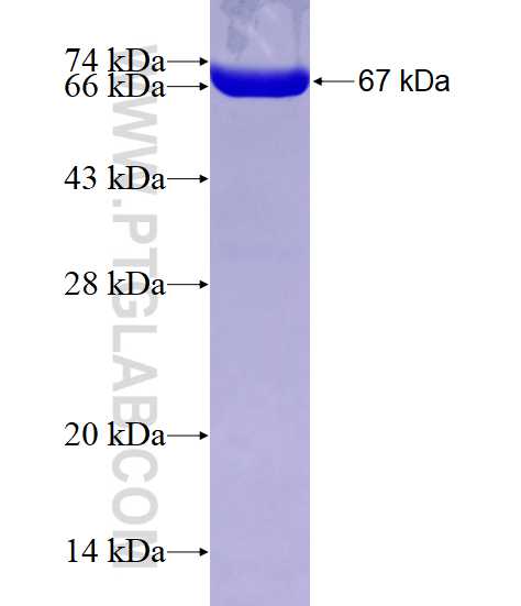 UROD fusion protein Ag7905 SDS-PAGE