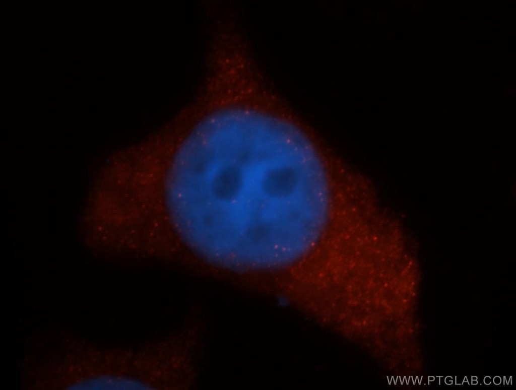 Immunofluorescence (IF) / fluorescent staining of MCF-7 cells using UROS Polyclonal antibody (14913-1-AP)