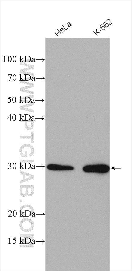 Western Blot (WB) analysis of various lysates using UROS Polyclonal antibody (14913-1-AP)