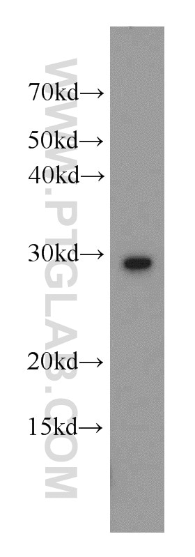 Western Blot (WB) analysis of K-562 cells using UROS Polyclonal antibody (14913-1-AP)