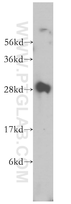 Western Blot (WB) analysis of K-562 cells using UROS Polyclonal antibody (14913-1-AP)