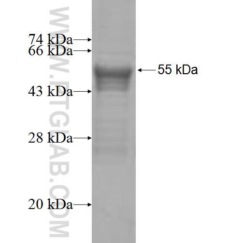 UROS fusion protein Ag6711 SDS-PAGE