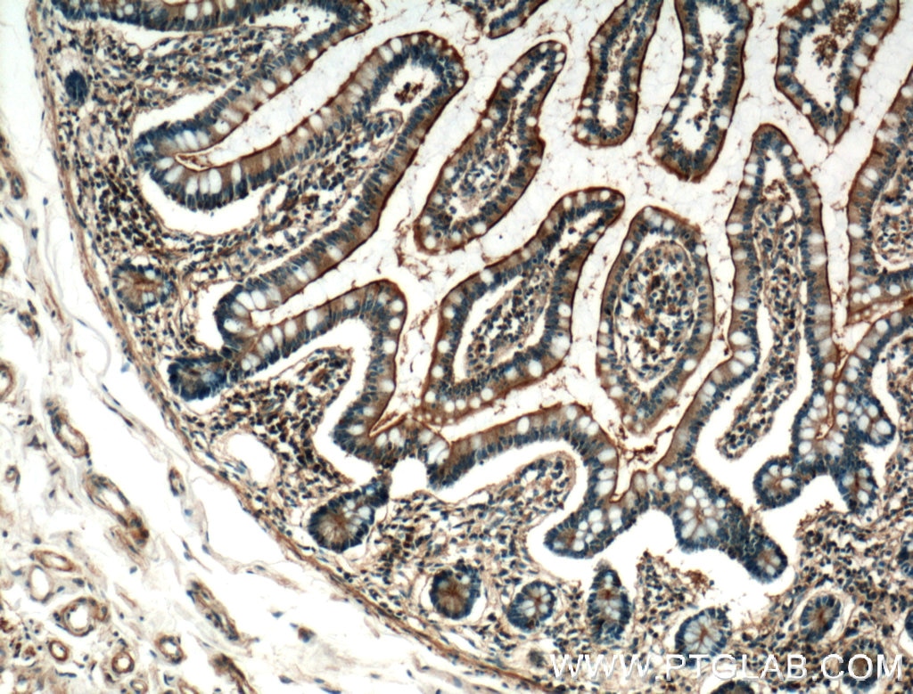 Immunohistochemistry (IHC) staining of human small intestine tissue using USE1 Polyclonal antibody (25218-1-AP)