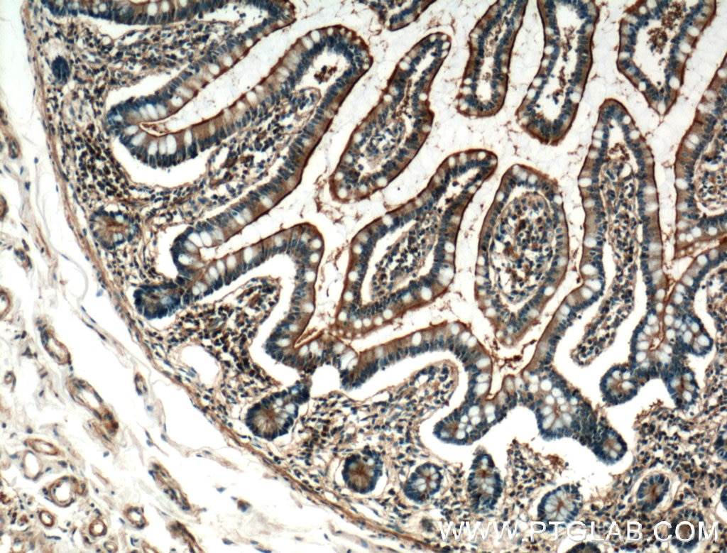 IHC staining of human small intestine using 25218-1-AP