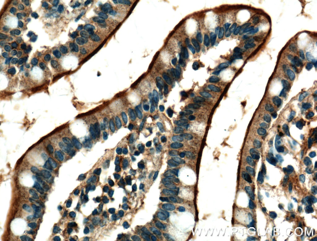 Immunohistochemistry (IHC) staining of human small intestine tissue using USE1 Polyclonal antibody (25218-1-AP)