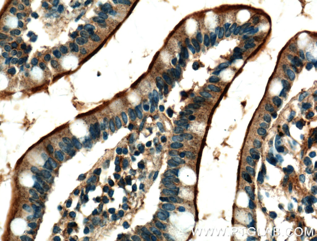 IHC staining of human small intestine using 25218-1-AP