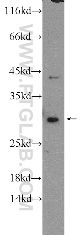 Western Blot (WB) analysis of Jurkat cells using USE1 Polyclonal antibody (25218-1-AP)