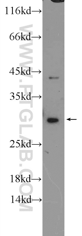 WB analysis of Jurkat using 25218-1-AP