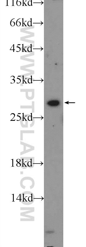 Western Blot (WB) analysis of HEK-293 cells using USE1 Polyclonal antibody (25218-1-AP)