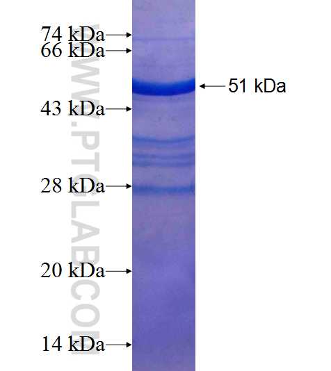 USE1 fusion protein Ag18587 SDS-PAGE