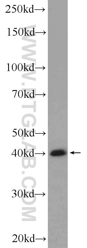 Western Blot (WB) analysis of HeLa cells using USF1 Polyclonal antibody (22327-1-AP)