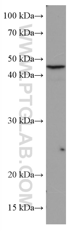 WB analysis of HeLa using 67114-1-Ig