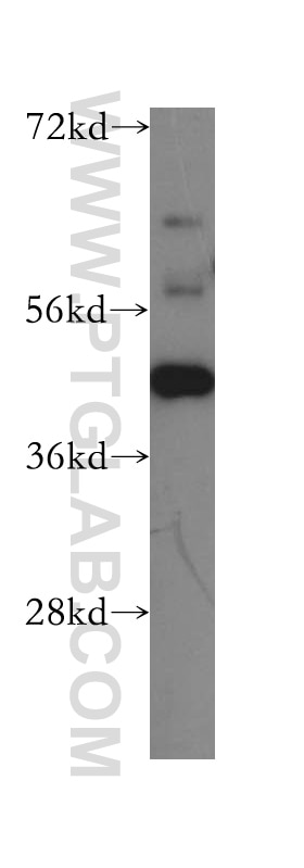 Western Blot (WB) analysis of Jurkat cells using USF2 Polyclonal antibody (16614-1-AP)