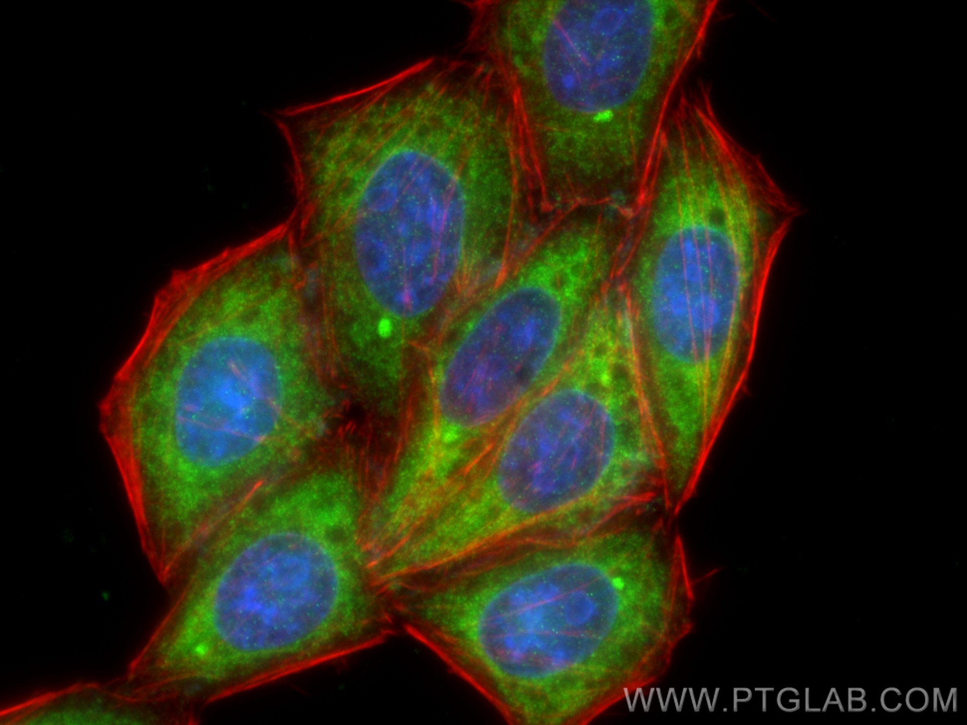 Immunofluorescence (IF) / fluorescent staining of HepG2 cells using Harmonin Polyclonal antibody (11358-1-AP)
