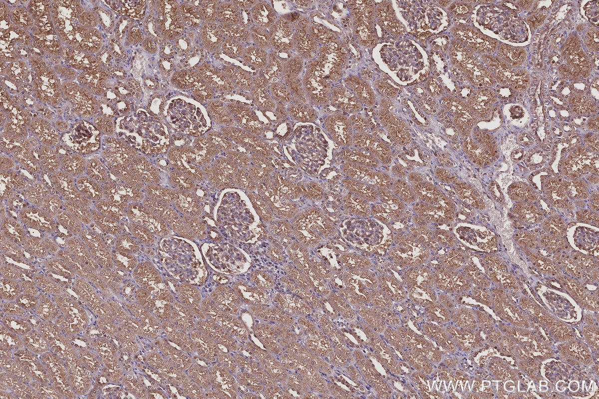 Immunohistochemistry (IHC) staining of human kidney tissue using Harmonin Polyclonal antibody (11358-1-AP)