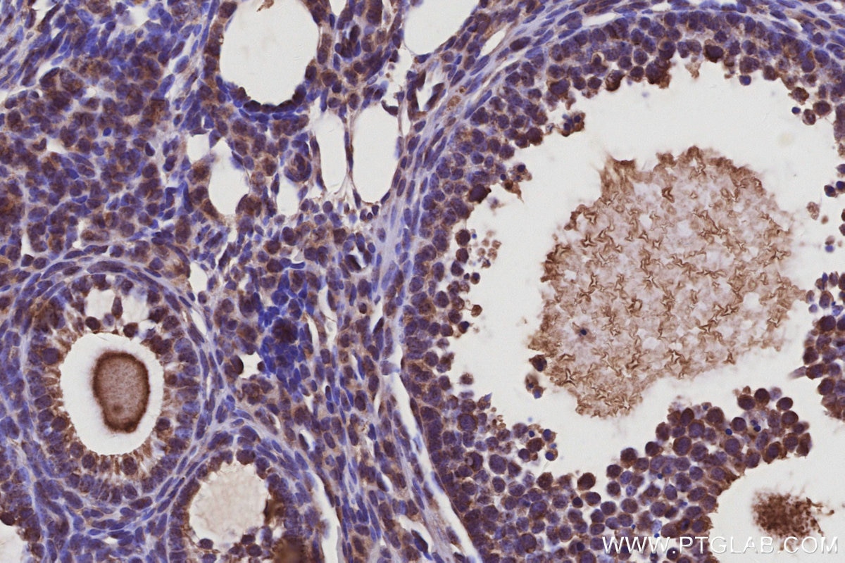 Immunohistochemistry (IHC) staining of mouse ovary tissue using Harmonin Polyclonal antibody (11358-1-AP)