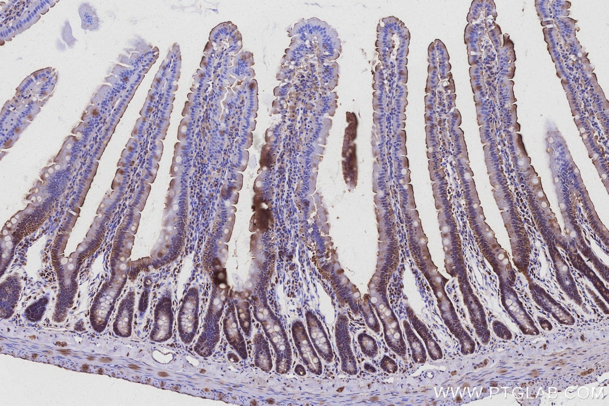 Immunohistochemistry (IHC) staining of rat small intestine tissue using Harmonin Polyclonal antibody (11358-1-AP)