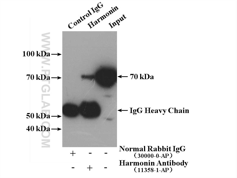 Immunoprecipitation (IP) experiment of HEK-293 cells using Harmonin Polyclonal antibody (11358-1-AP)