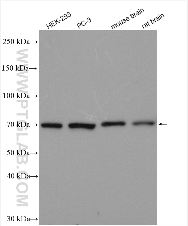 Western Blot (WB) analysis of various lysates using Harmonin Polyclonal antibody (11358-1-AP)