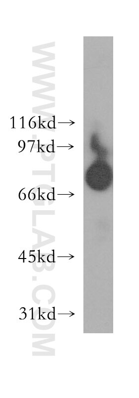 Western Blot (WB) analysis of HEK-293 cells using Harmonin Polyclonal antibody (11358-1-AP)