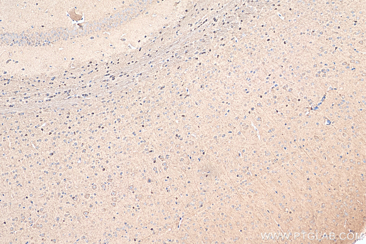 Immunohistochemistry (IHC) staining of mouse brain tissue using USH1G Polyclonal antibody (21936-1-AP)